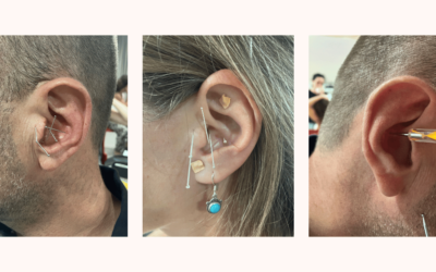 Auriculotherapy – alternative therapy: does it really work?